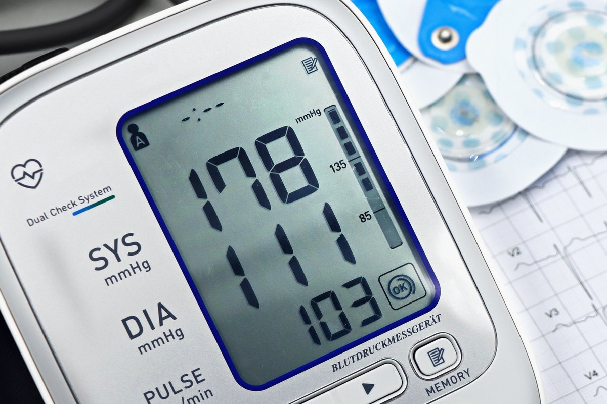 A white blood pressure monitor with its screen showing a reading, next to a printed ECG strip
