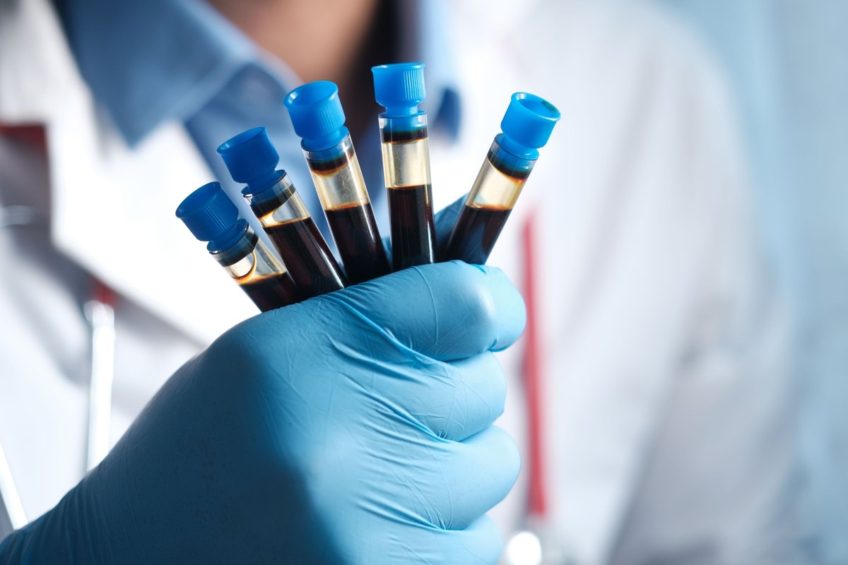 Blue-gloved hand holding five blood sample tubes with blue caps
