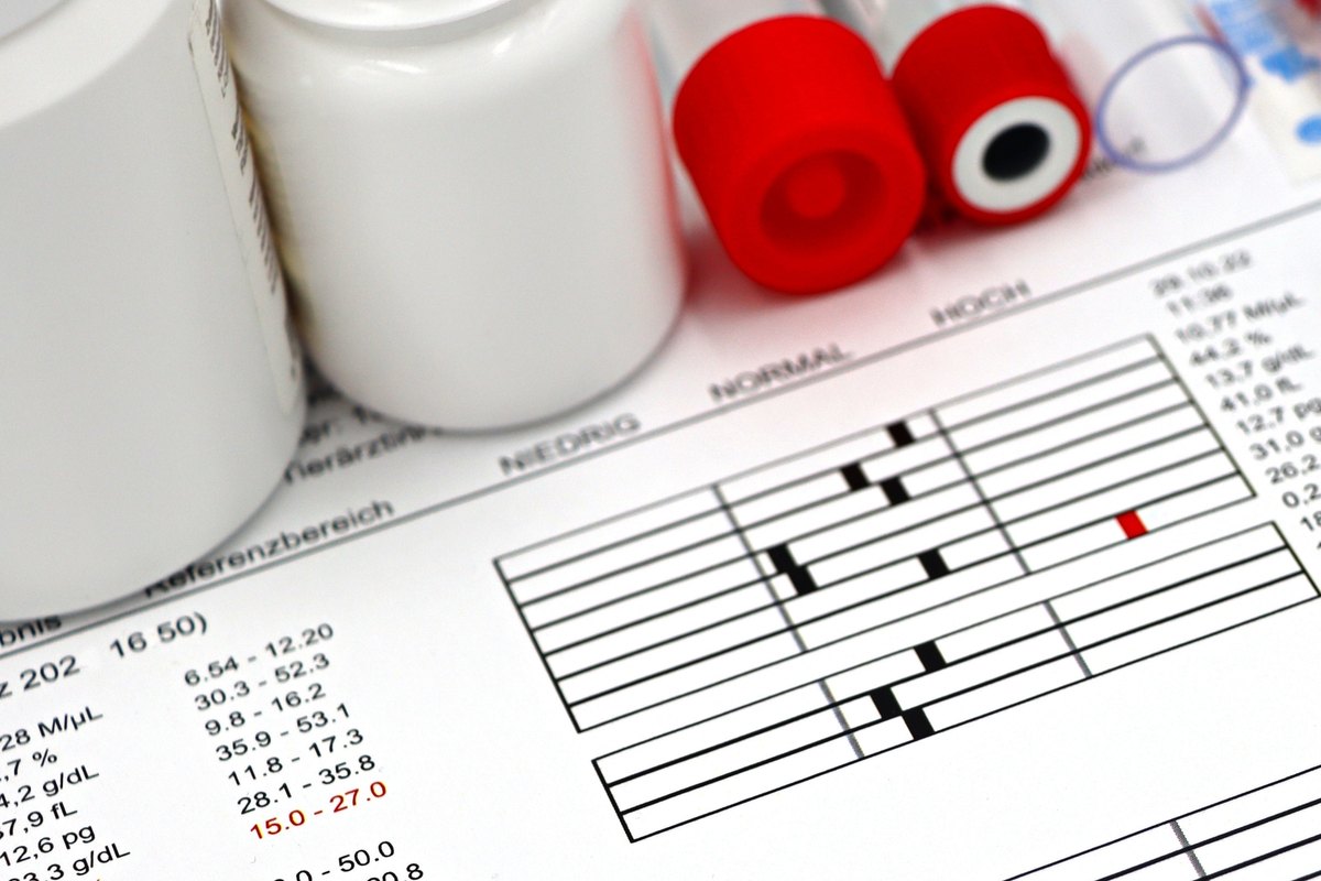 Printed blood test results on a table beside red-capped sample tubes and white medicine bottles